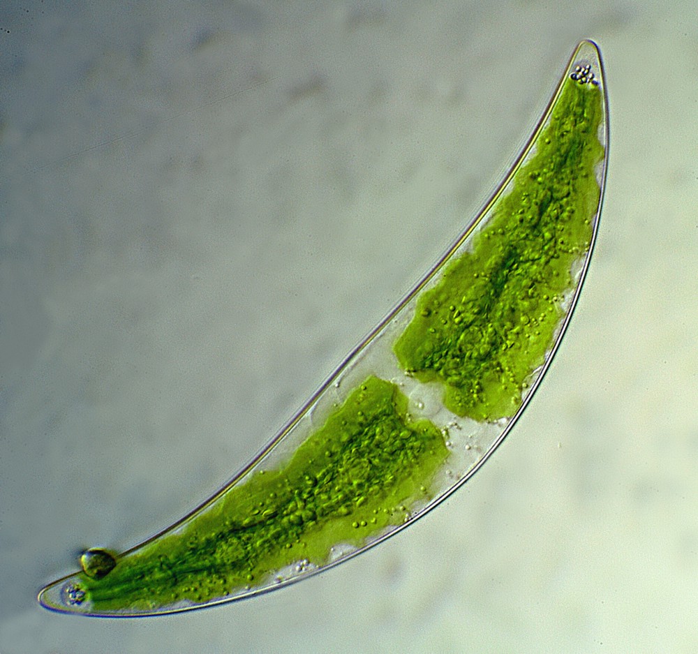 Closterium